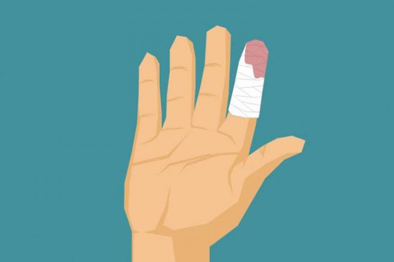 Tips Darurat Atasi Sakit Akibat Terjepit