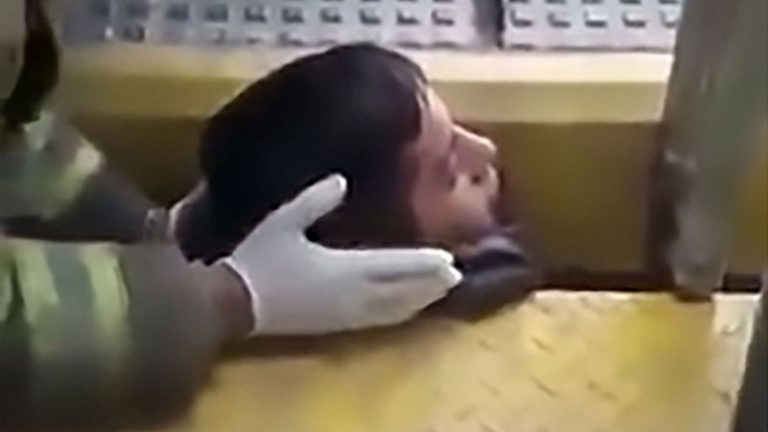 Dramatis! Kepala Pria ini Tersangkut di Celah Peron Stasiun